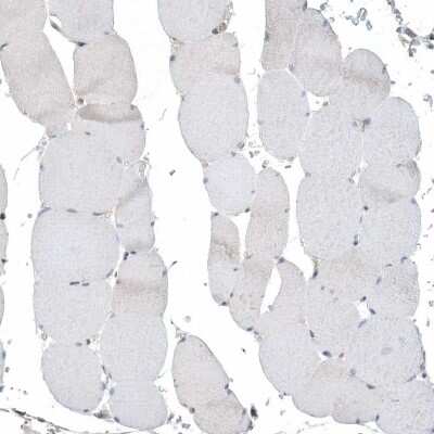 Immunohistochemistry-Paraffin: PSD4 Antibody [NBP2-38217]