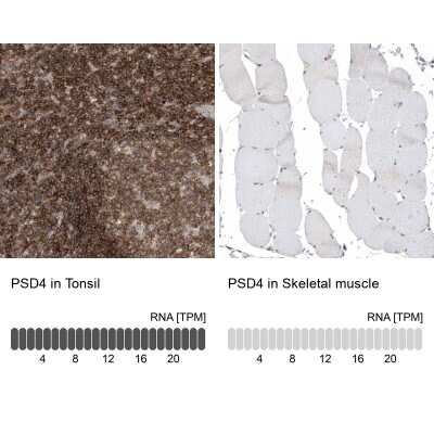 Immunohistochemistry-Paraffin: PSD4 Antibody [NBP2-38217]