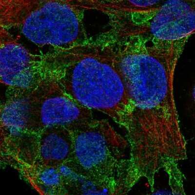 Immunocytochemistry/ Immunofluorescence: PSD93 Antibody [NBP2-58558]