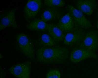 Immunocytochemistry/ Immunofluorescence: PSENEN/PEN2 Antibody (JE41-28) [NBP2-75632]
