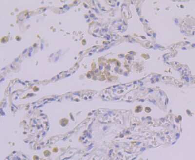 Immunohistochemistry-Paraffin: PSENEN/PEN2 Antibody (JE41-28) [NBP2-75632]