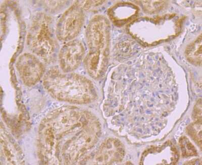 Immunohistochemistry-Paraffin: PSENEN/PEN2 Antibody (JE41-28) [NBP2-75632]