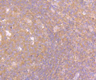 Immunohistochemistry-Paraffin: PSENEN/PEN2 Antibody (JE41-28) [NBP2-75632]