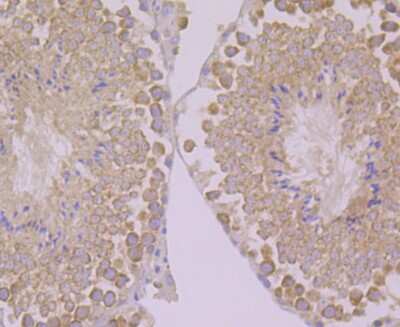 Immunohistochemistry-Paraffin: PSENEN/PEN2 Antibody (JE41-28) [NBP2-75632]