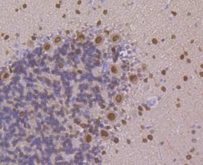 Immunohistochemistry-Paraffin: PSENEN/PEN2 Antibody (JE41-28) [NBP2-75632]