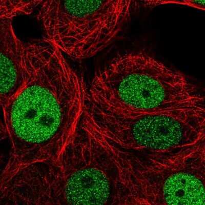 Immunocytochemistry/ Immunofluorescence: PSF2 Antibody [NBP2-33825]