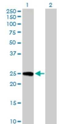 Western Blot: PSF3 Antibody [H00064785-B01P]