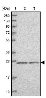 Western Blot: PSF3 Antibody [NBP1-92300]