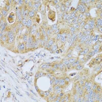 Immunohistochemistry-Paraffin: PSG1 Antibody - BSA Free [NBP2-93944]