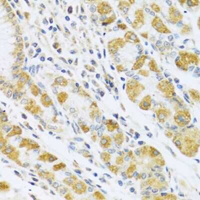 Immunohistochemistry-Paraffin: PSG1 Antibody - BSA Free [NBP2-93944]
