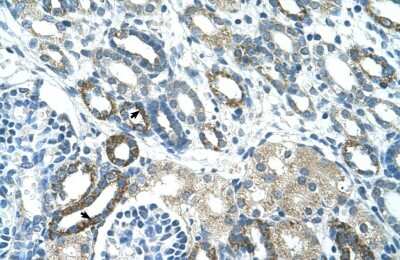 Immunohistochemistry-Paraffin: PSG3 Antibody [NBP1-55491]
