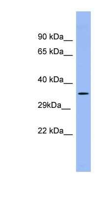 Western Blot: PSG5 Antibody [NBP1-57962]