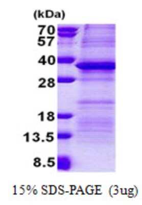 SDS-PAGE: Recombinant Human PSG5 His Protein [NBP2-23358]