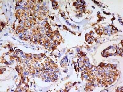 Immunohistochemistry: PSGL-1/CD162 Antibody (HECA-452) - Azide and BSA Free [NBP2-80921]