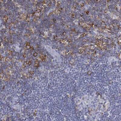 Immunohistochemistry-Paraffin: PSGL-1/CD162 Antibody [NBP3-16974]