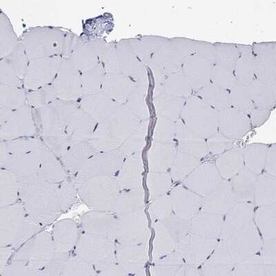Immunohistochemistry-Paraffin: PSGL-1/CD162 Antibody [NBP3-16974]