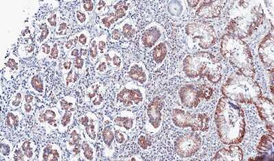 Immunohistochemistry-Paraffin: PSKH2 Antibody [NBP1-31467]