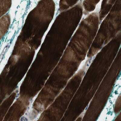 Immunohistochemistry-Paraffin: PSKH2 Antibody [NBP1-86459]