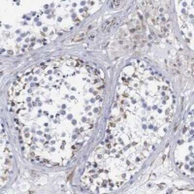 Immunohistochemistry-Paraffin: PSKH2 Antibody [NBP3-17421]