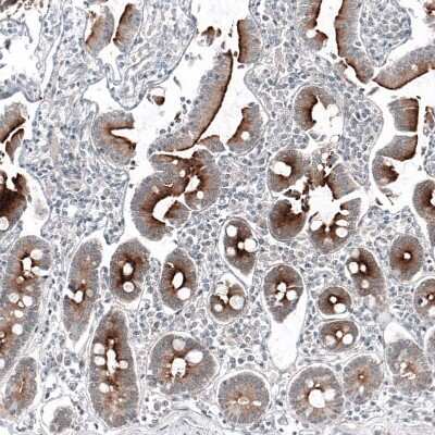 Immunohistochemistry-Paraffin: PSMA/FOLH1/NAALADase I Antibody (CL9089) [NBP2-88924]