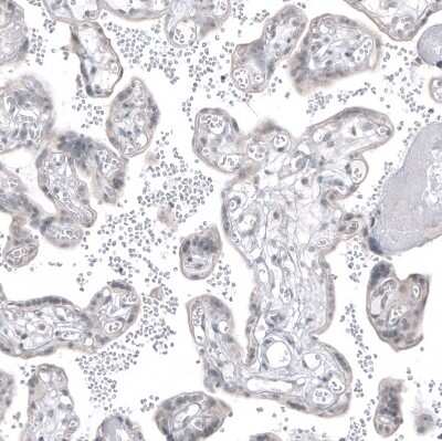 Immunohistochemistry-Paraffin: PSMA/FOLH1/NAALADase I Antibody (CL9089) [NBP2-88924]