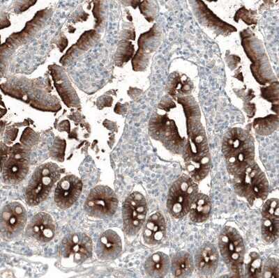 Immunohistochemistry-Paraffin: PSMA/FOLH1/NAALADase I Antibody (CL9091) [NBP2-88925]