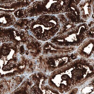 Immunohistochemistry-Paraffin: PSMA/FOLH1/NAALADase I Antibody (CL9091) [NBP2-88925]