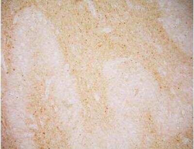 Immunohistochemistry: PSMA/FOLH1/NAALADase I Antibody (GCP-04) - BSA Free [NBP1-45057]