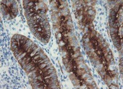 Immunohistochemistry-Paraffin: PSMA/FOLH1/NAALADase I Antibody (OTI3H5) - Azide and BSA Free [NBP2-73686]