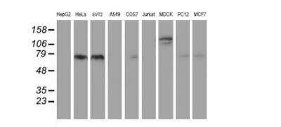 Western Blot: PSMA/FOLH1/NAALADase I Antibody (OTI3H5)Azide and BSA Free [NBP2-73686]