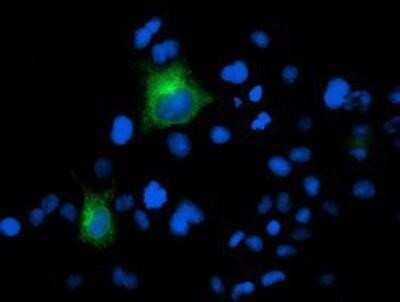 Immunocytochemistry/ Immunofluorescence: PSMA/FOLH1/NAALADase I Antibody (OTI3H5) [NBP2-02045]
