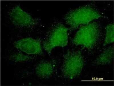 Immunocytochemistry/ Immunofluorescence: PSMA1 Antibody (1D9-1C7) [H00005682-M01]