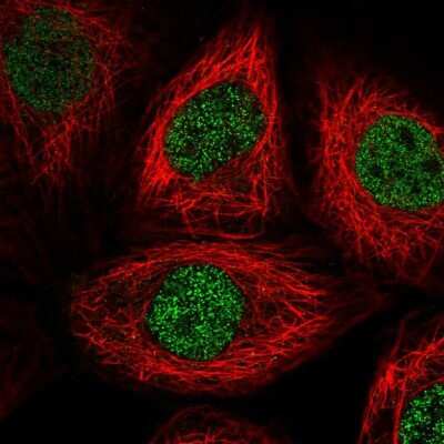 Immunocytochemistry/ Immunofluorescence: PSMA1 Antibody [NBP2-37908]