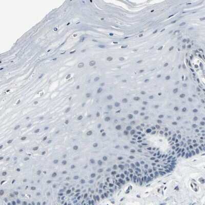 Immunohistochemistry-Paraffin: PSMA2 Antibody [NBP1-92292]