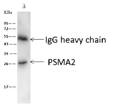 Immunoprecipitation: PSMA2 Antibody [NBP2-99609]