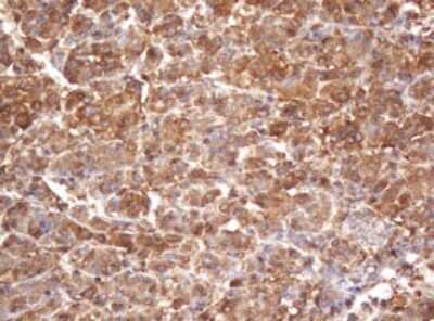 Immunohistochemistry: PSMA2 Antibody (OTI3D9) - Azide and BSA Free [NBP2-73687]