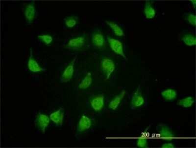 Immunocytochemistry/ Immunofluorescence: PSMA4 Antibody (2A10-E4) [H00005685-M01]