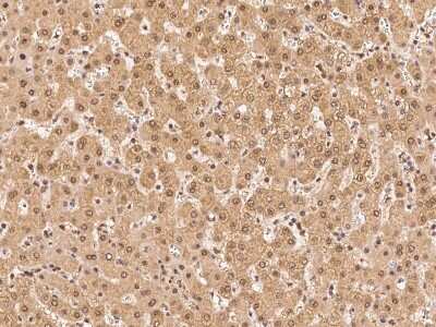 Immunohistochemistry-Paraffin: PSMA4 Antibody [NBP2-99610]