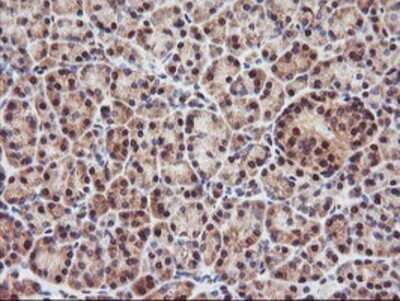 Immunohistochemistry: PSMA4 Antibody (OTI4B8) - Azide and BSA Free [NBP2-73690]