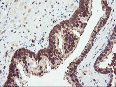 Immunohistochemistry: PSMA4 Antibody (OTI4B8) - Azide and BSA Free [NBP2-73690]