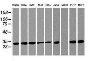 Western Blot: PSMA4 Antibody (OTI4B8)Azide and BSA Free [NBP2-73690]