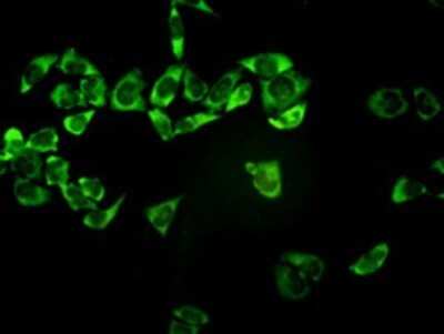 Immunocytochemistry/ Immunofluorescence: PSMA7 Antibody (1A10-3G12) [H00005688-M01]