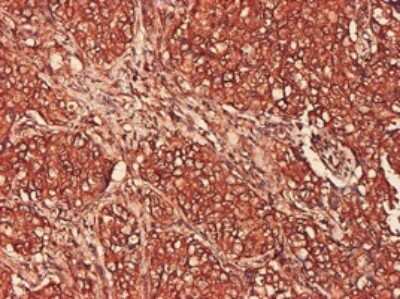 Immunohistochemistry-Paraffin: PSMA7 Antibody (1A10-3G12) [H00005688-M01]