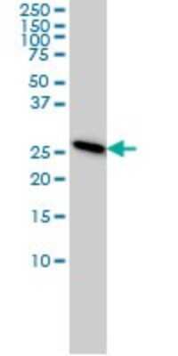 Western Blot: PSMA7 Antibody (1A10-3G12) [H00005688-M01]