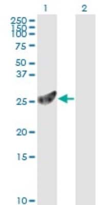 Western Blot: PSMA7 Antibody (1A10-3G12) [H00005688-M01]
