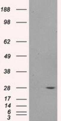 Western Blot: PSMA7 Antibody (OTI3F11) [NBP2-02120]