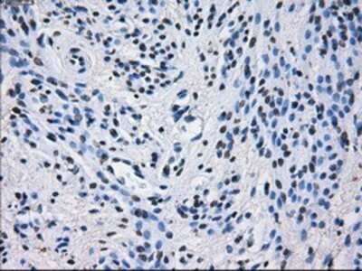 Immunohistochemistry: PSMA7 Antibody (OTI3F11) - Azide and BSA Free [NBP2-73693]