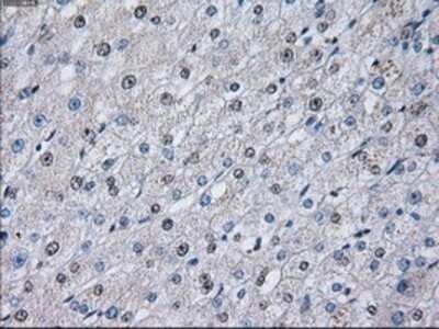 Immunohistochemistry: PSMA7 Antibody (OTI3F11) - Azide and BSA Free [NBP2-73693]