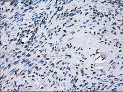 Immunohistochemistry: PSMA7 Antibody (OTI3F11) - Azide and BSA Free [NBP2-73693]