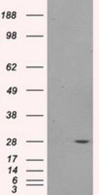 Western Blot: PSMA7 Antibody (OTI3F11)Azide and BSA Free [NBP2-73693]